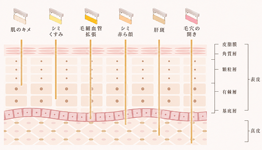6種類のフィルターで、あらゆる肌悩みにオーダーメイド対応
