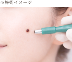 くり抜き法