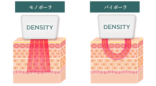 モノポーラRF バイポーラRF