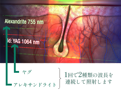 1回で2種類の波長を連続照射