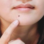 ほくろを指さす女性