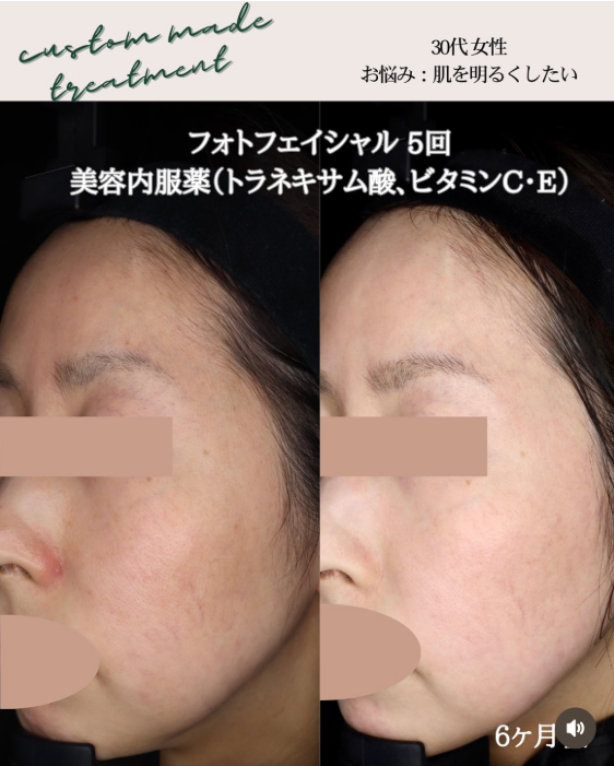 みやまクリニックインスタグラム