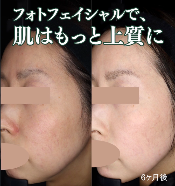 みやまクリニックの症例写真インスタグラム